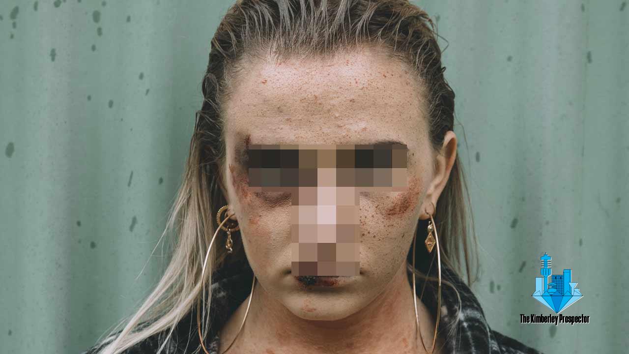 Mother, three children rescued on a farm from abusive Keimoes man Mother, three children rescued on a farm from abusive Keimoes man